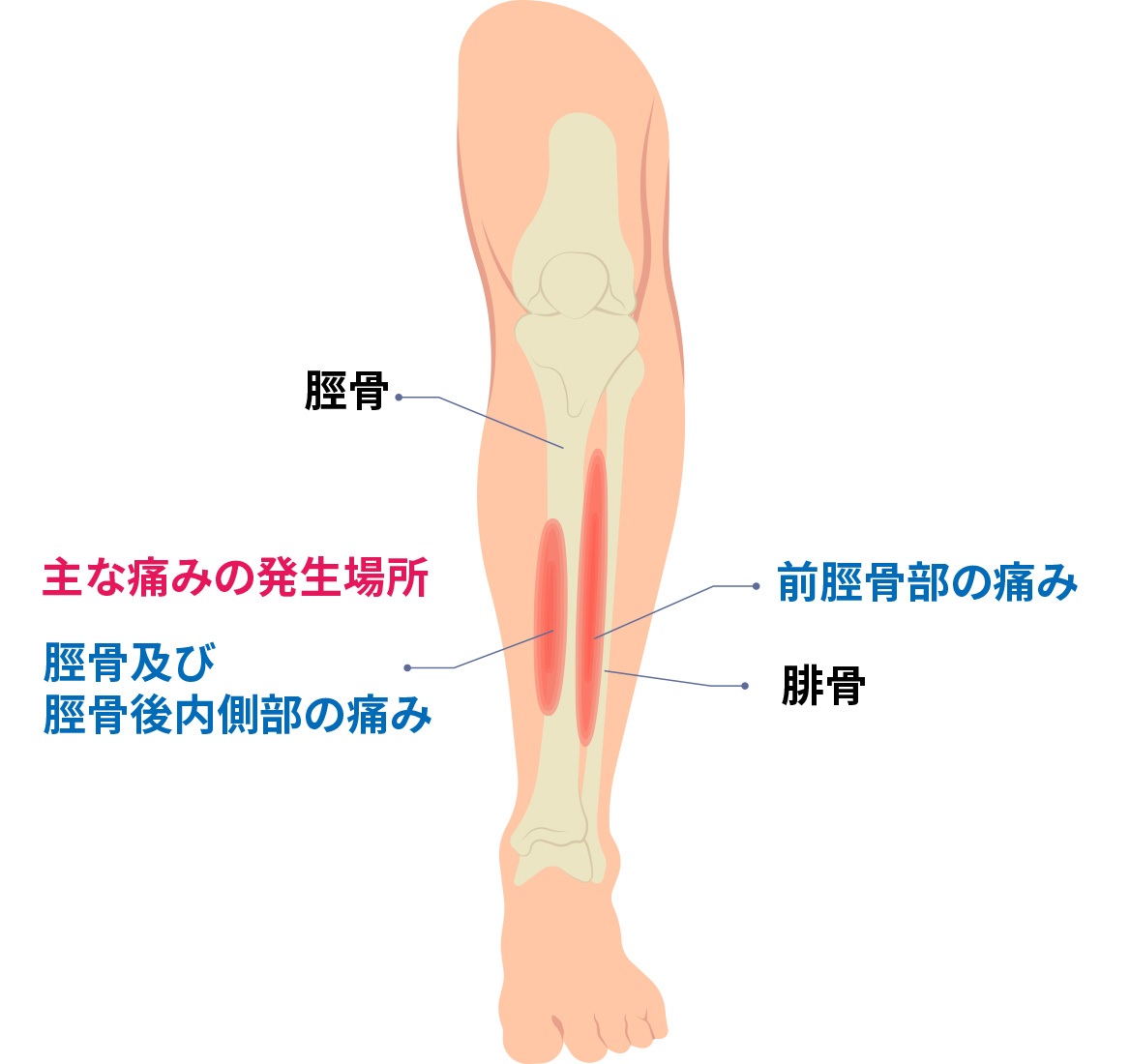 Is jc すね 我汝会きたひろしま整形外科