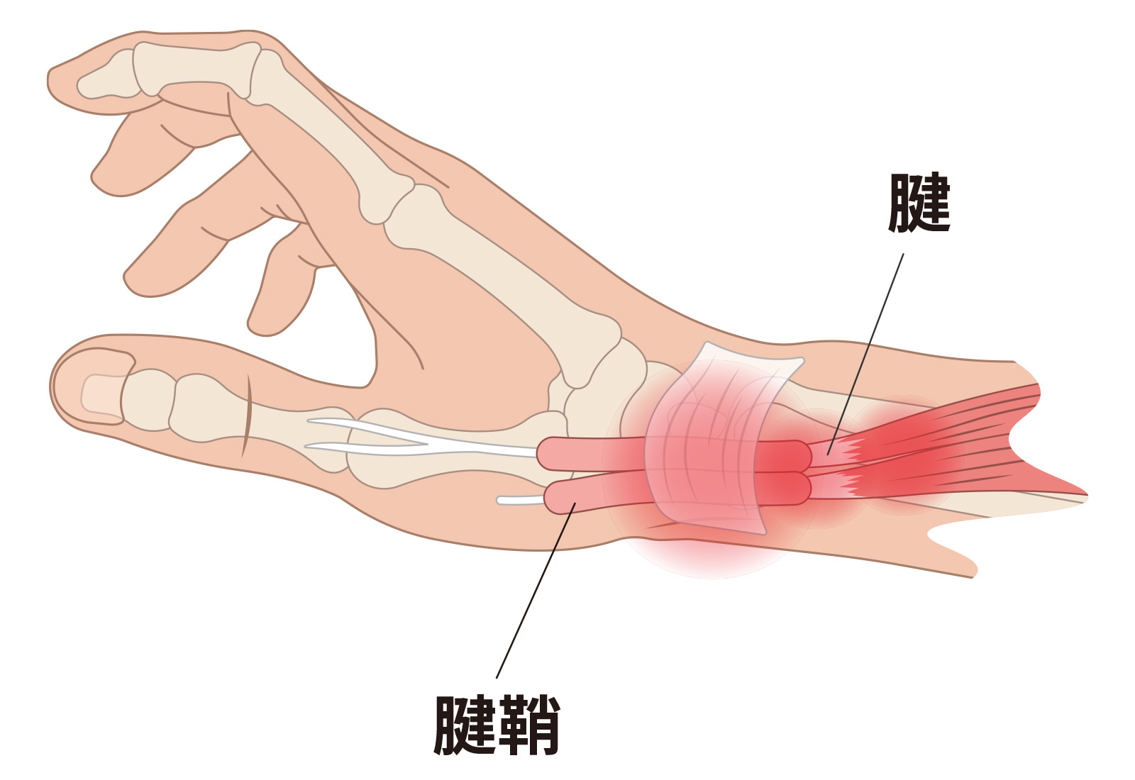 腱鞘炎・ドケルバン病｜手首の親指側の痛みを感じたら｜ジャーナル（サポーター）｜ザムスト公式オンラインショップ【ZAMST Online】