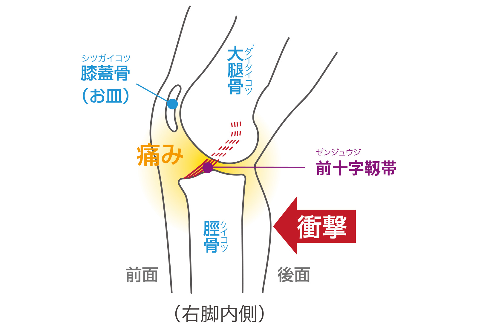 膝前十字靱帯（ACL）損傷とは｜膝関節の代表的なスポーツ障害｜ジャーナル（サポーター）｜ザムスト公式オンラインショップ【ZAMST Online】